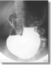 胃部X線写真